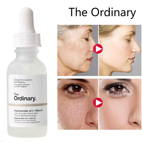 Ordinary Niacinamide 10% + Zinc 1%